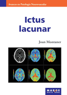 Ictus lacunar