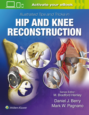 Illustrated Tips and Tricks in Hip and Knee Reconstructive and Replacement Surgery - Berry, Daniel J, MD (Editor), and Pagnano, Mark W, MD (Editor)