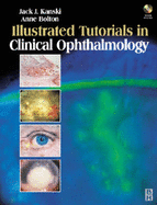 Illustrated Tutorials in Clinical Ophthalmology - Kanski, Jack J, MD, MS, Frcs, and Bolton, Anne