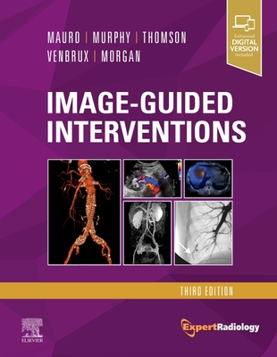 Image-Guided Interventions: Expert Radiology Series - Thomson, Kenneth R, MD, and Mauro, Matthew A, MD, Facr (Editor), and Murphy, Kieran P J, MB, Frcpc (Editor)