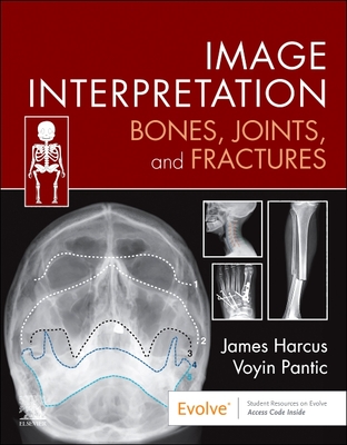 Image Interpretation: Bones, Joints, and Fractures - Harcus, James, and Pantic, Voyin