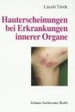 Hauterscheinungen Bei Erkrankungen Innerer Organe Dermatosen Dickdarmpolypose Perianale Hyperpigmentierung Blickdiagnose Haut Innere Medizin Dermatologie Hautarzt Dermatologe Lyme-Borreliose Frherkennung Malignome Morbus Crohn Makromorphologie...