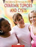 Ovarian Tumors and Cysts