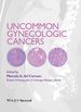 Uncommon Gynecologic Cancers