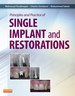 Principles and Practice of Single Implant and Restoration