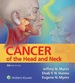 Cancer of the Head and Neck