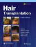 Hair Transplantation