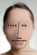 Face/on