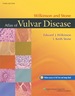 Wilkinson and Stone Atlas of Vulvar Disease