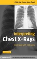 Interpreting Chest X-Rays