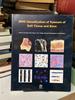 Who Classification of Tumours of Soft Tissue and Bone (Fourth Edition)