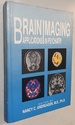 Brain Imaging: Applications in Psychiatry