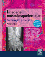 Imagerie Musculosquelettique: Pathologies Gnrales