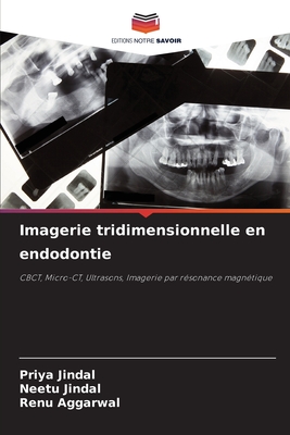 Imagerie tridimensionnelle en endodontie - Jindal, Priya, and Jindal, Neetu, and Aggarwal, Renu