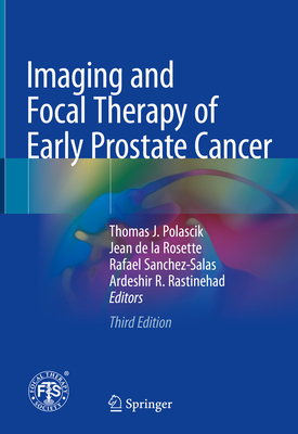 Imaging and Focal Therapy of Early Prostate Cancer - Polascik, Thomas J. (Editor), and de la Rosette, Jean (Editor), and Sanchez-Salas, Rafael (Editor)