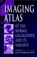 Imaging Atlas of the Normal Gallbladder and Its Variants - Meilstrup M D, Jon W