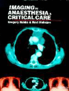 Imaging in Anaesthesia and Critical Care - Hobbs, Gregory J, and Mahajan, Ravi P, DM