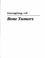Imaging of Bone Tumors: A Multidisciplinary Approach