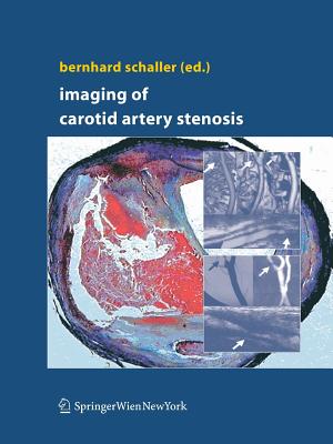 Imaging of Carotid Artery Stenosis - Schaller, Bernhard (Editor)