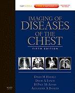 Imaging of Diseases of the Chest: Expert Consult - Online and Print