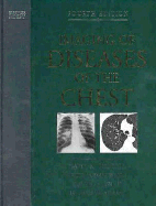 Imaging of Diseases of the Chest - Armstrong, Peter, Frcp, and Hansell, David M, and Lynch, David A, MD