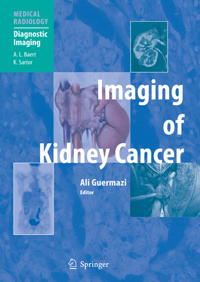 Imaging of Kidney Cancer - Guermazi, Ali, MD (Editor), and Baert, A L (Foreword by), and Bosniak, M a (Foreword by)