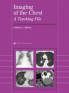 Imaging of the Chest: A Teaching File