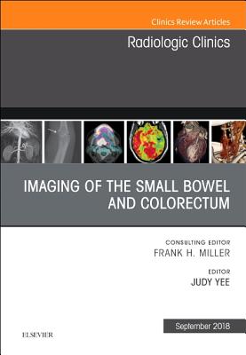 Imaging of the Small Bowel and Colorectum, an Issue of Radiologic Clinics of North America: Volume 56-5 - Yee, Judy, MD