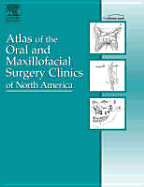 Implant Procedures, an Issue of Atlas of the Oral and Maxillofacial Surgery Clinics: Volume 14-1 - Block, Michael S