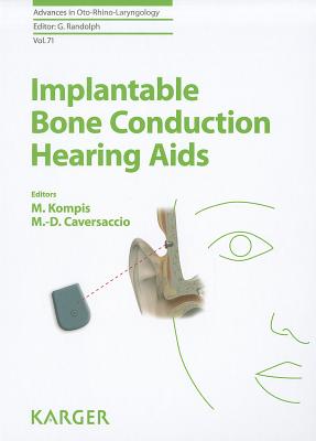 Implantable Bone Conduction Hearing Aids - Kompis, M. (Editor), and Caversaccio, M.-D. (Editor), and Bradley, Patrick J. (Series edited by)