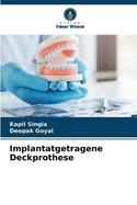 Implantatgetragene Deckprothese