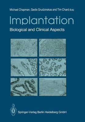 Implantation: Biological and Clinical Aspects - Chapman, Michael G (Editor), and Grudzinskas, J Gedis (Editor), and Chard, Tim (Editor)