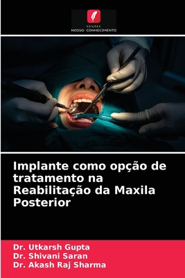 Implante como op??o de tratamento na Reabilita??o da Maxila Posterior - Gupta, Utkarsh, Dr., and Saran, Shivani, Dr., and Sharma, Akash Raj, Dr.