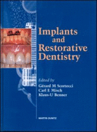 Implants and Restorative Dentistry - Scortecci, Grard M, and Misch, Carl E, and Benner, Klaus U