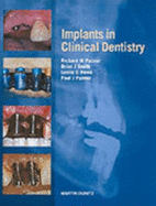 Implants in Clinical Dentistry - Palmer, Richard M, and Howe, Leslie C, and Palmer, Paul J