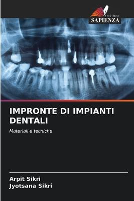 Impronte Di Impianti Dentali - Sikri, Arpit, and Sikri, Jyotsana