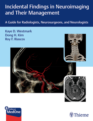 Incidental Findings in Neuroimaging and Their Management: A Guide for Radiologists, Neurosurgeons, and Neurologists - Westmark, Kaye D, and Kim, Dong H, and Riascos-Castaneda, Roy F