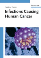 Infections Causing Human Cancer - Zur Hausen, Harald, and Fox, James G (Contributions by), and Wang, Timothy C (Contributions by)