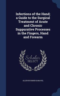 Infections of the Hand; a Guide to the Surgical Treatment of Acute and Chronic Suppurative Processes in the Fingers, Hand and Forearm - Kanavel, Allen Buckner