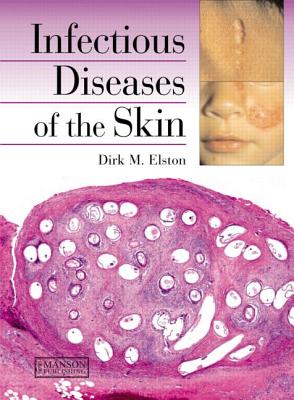 Infectious Diseases of the Skin - Elston, Dirk