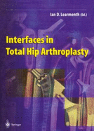 Interfaces in Total Hip Arthroplasty - Learmonth, Ian D (Editor)