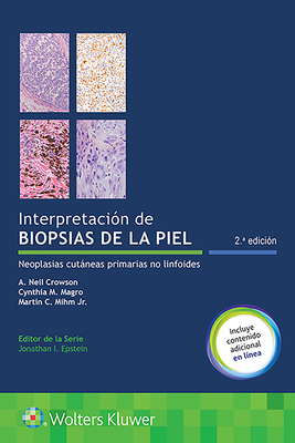 Interpretacin de Biopsias de la Piel: Neoplasias Cutneas Primarias No Linfoides - Crowson, A Neil, MD, and Magro, Cynthia M, MD, and Mihm, Martin C, Jr., MD