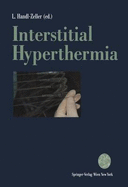 Interstitial Hyperthermia - Handl-Zeller, Leonore (Editor)