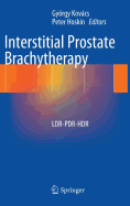 Interstitial Prostate Brachytherapy: Ldr-Pdr-Hdr