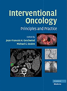 Interventional Oncology: Principles and Practice