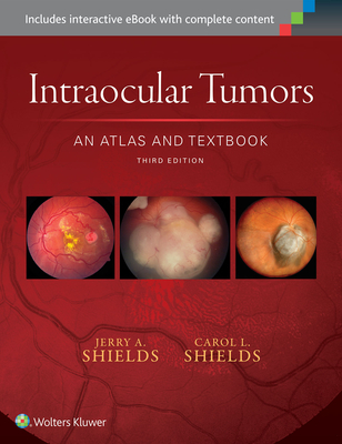 Intraocular Tumors: An Atlas and Textbook - Shields, Jerry A., Dr., and Shields, Carol L., Dr.
