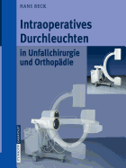 Intraoperatives Durchleuchten in Unfallchirurgie Und Orthop?die