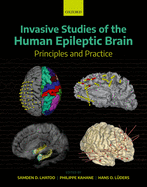 Invasive Studies of the Human Epileptic Brain: Principles and Practice
