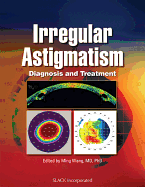 Irregular Astigmatism: Diagnosis and Treatment