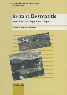 Irritant Dermatitis: New Clinical and Experimental Aspects - Elsner, P. (Editor), and Maibach, H.I. (Editor), and Itin, P. (Series edited by)